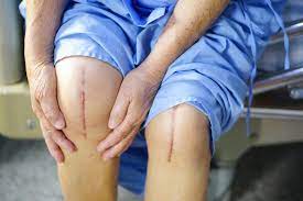 Knee and hip replacement specialists